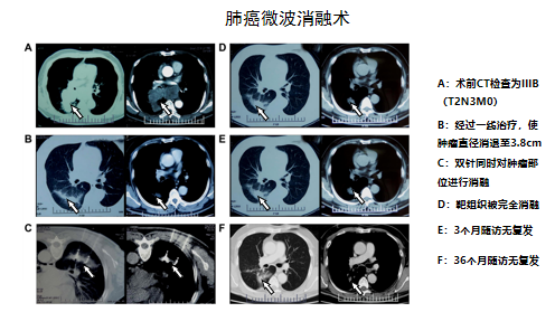 1681782052919430.png 图片5.png